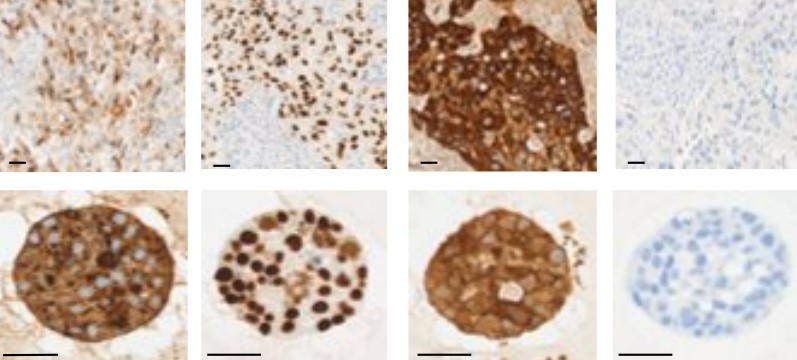 Winn Lab:  The Role of PRMTs in Lung Cancer